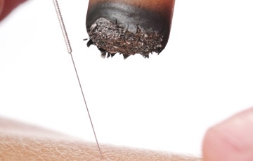 moxibustion-2